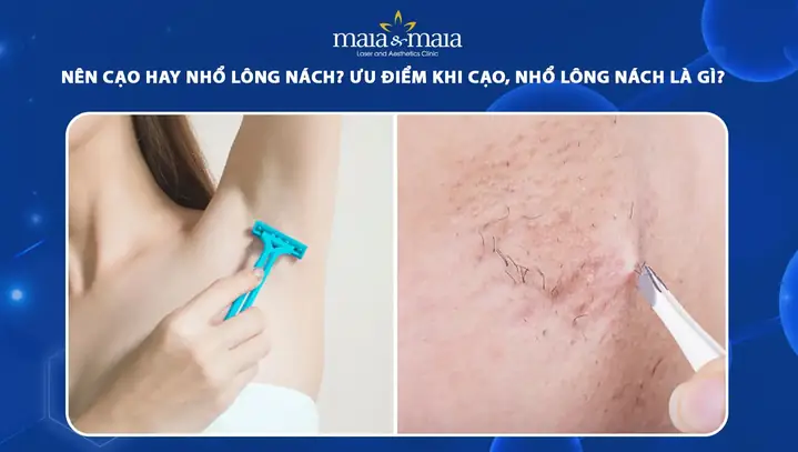Nên Nhổ Hay Nên Cạo Lông Nách
