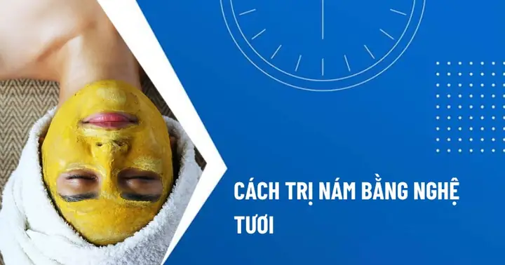 Nghệ Có Trị Nám Được Không Nghệ Có Trị Nám Được Không