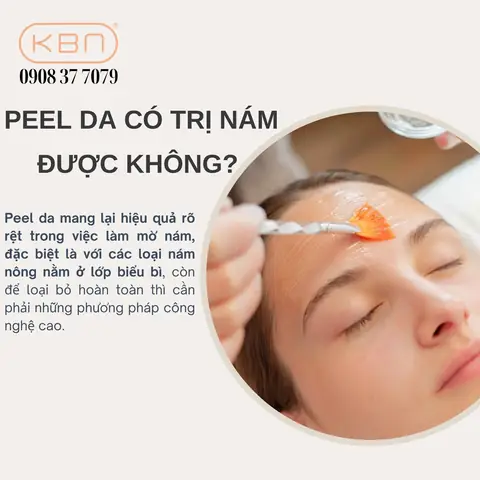 Nghệ Có Trị Nám Được Không Nghệ Có Trị Nám Được Không