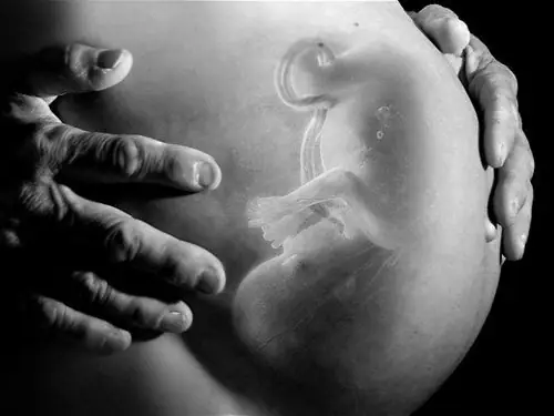 Nguyên Nhân Đường Kính Lưỡng Đỉnh Nhỏ