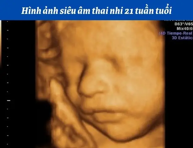 Nhạc Cho Thai Nhi 21 Tuần Tuổi