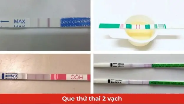 Nhận Biết Que Thử Thai 2 Vạch