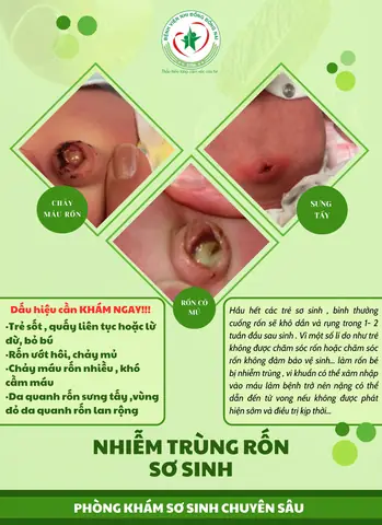 Nhiễm Trùng Rốn Bé Sơ Sinh