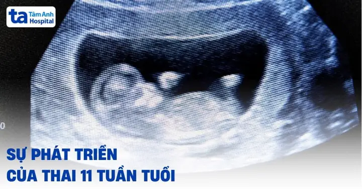 Nhịp Tim Của Thai Nhi Tuần Thứ 11