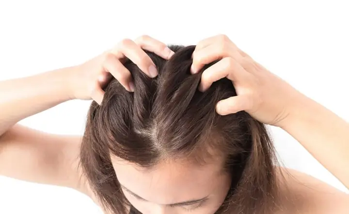 Những Cách Trị Chấy Tại Nhà