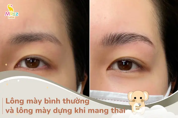 Những Dấu Hiệu Bình Thường Khi Mang Thai