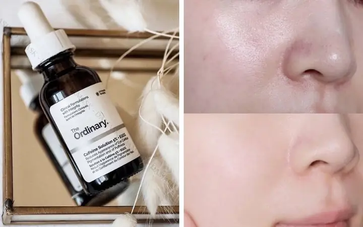 Những Loại Serum Trắng Da Tốt Nhất