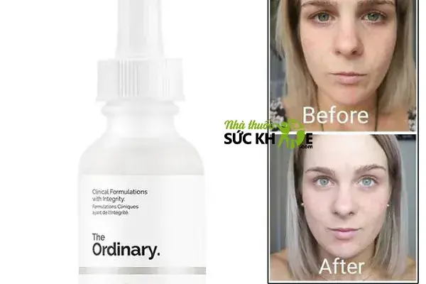 Niacinamide 10 Zinc 1 Cách Dùng