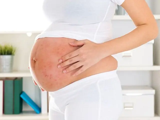 Nổi Mụn Lưng Bụng Khi Mang Thai
