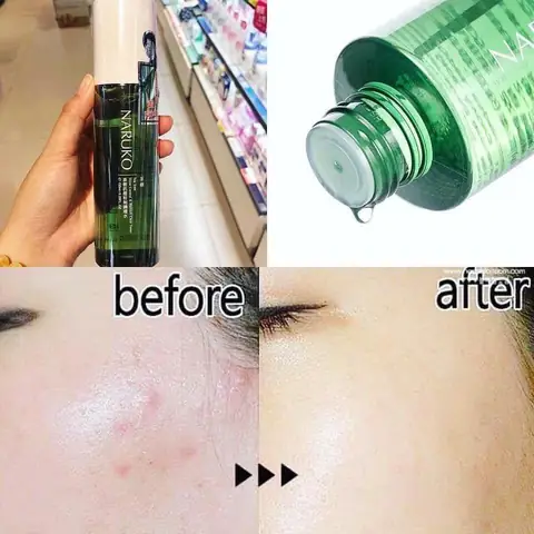 Nước Hoa Hồng Naruko Tea Tree Review