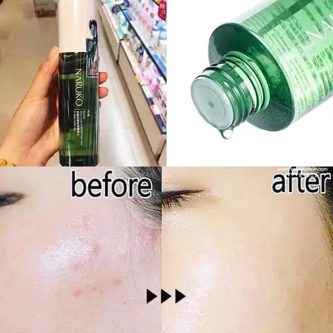 Nước Hoa Hồng Naruko Tea Tree Review