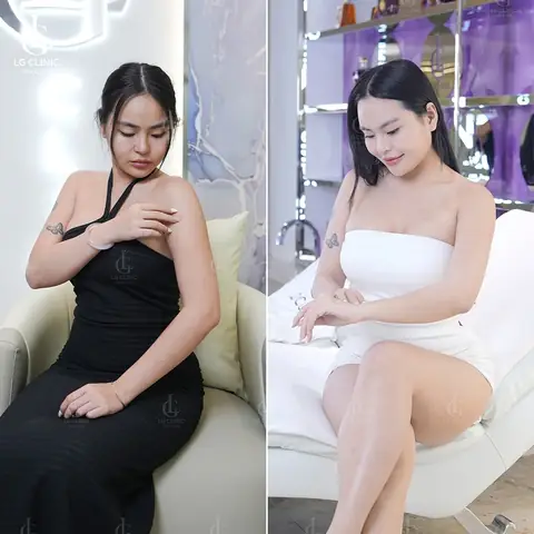 Phấn Rôm Làm Trắng Da Toàn Thân