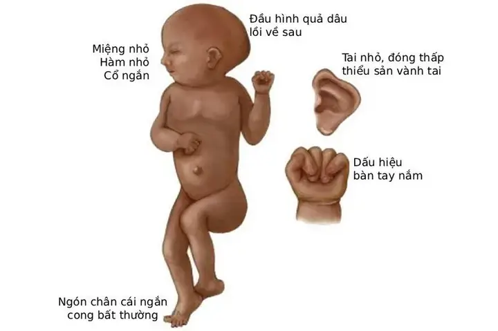 Phòng Khám Bé Bi Nguyễn Tiểu La