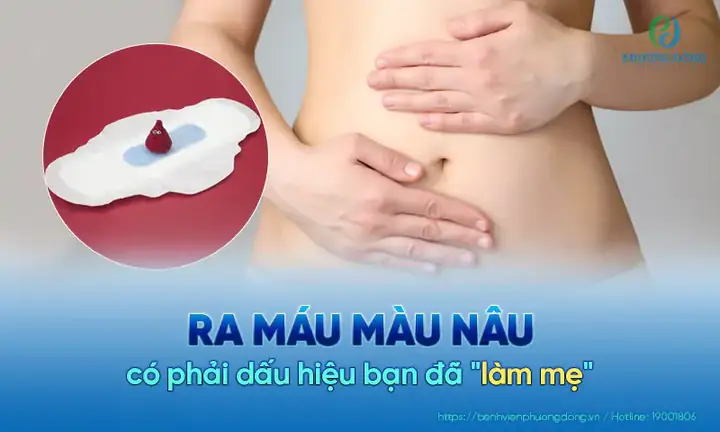 Ra Dịch Màu Nâu Có Phải Có Thai