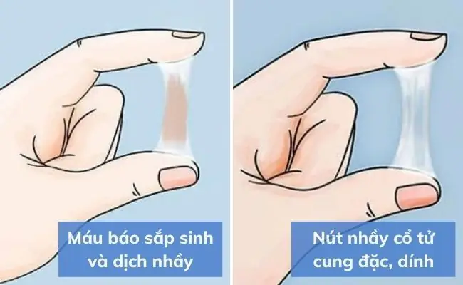 Ra Máu Báo Sau Bao Lâu Thì Đẻ