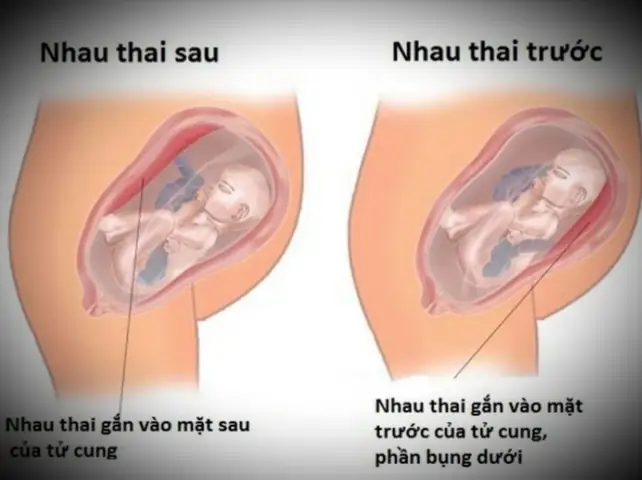Rau Bám Mặt Sau Là Trai Hay Gái