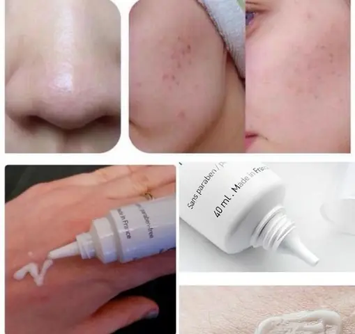 Review Kem Trị Mụn La Roche Posay Duo+