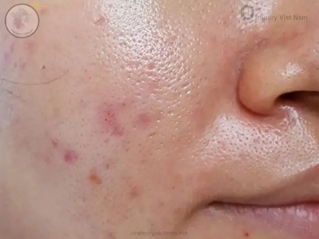 Rửa Mặt Mấy Lần Một Ngày Rửa Mặt Mấy Lần Một Ngày