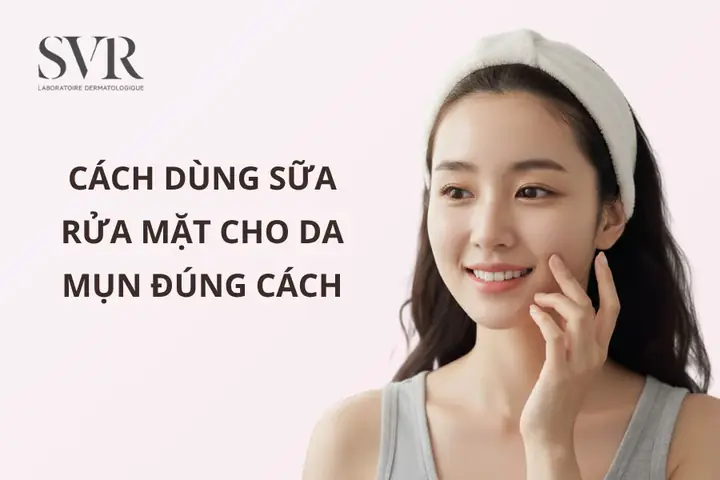 Rửa Mặt Như Thế Nào Để Hết Mụn