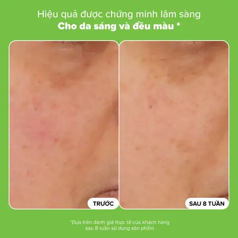 Sản Phẩm Thu Nhỏ Lỗ Chân Lông Hiệu Quả