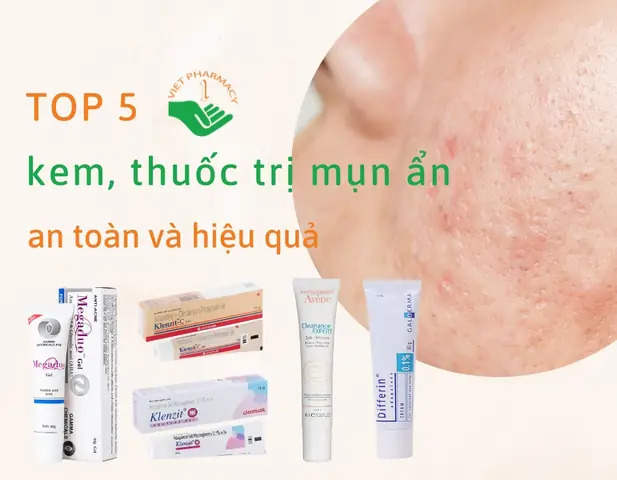 Sản Phẩm Trị Mụn Ẩn Tốt