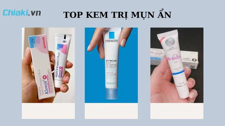 Sản Phẩm Trị Mụn Ẩn Tốt