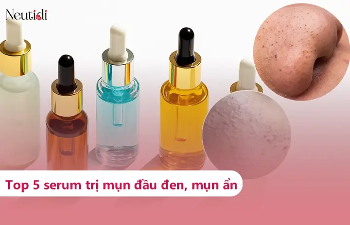 Sản Phẩm Trị Mụn Đầu Đen Cho Da Dầu