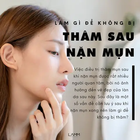 Sau Khi Lột Mụn Xong Nên Làm Gì