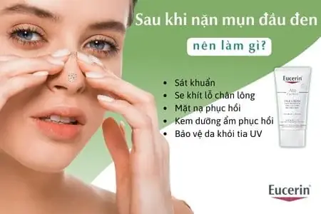 Sau Khi Lột Mụn Xong Nên Làm Gì
