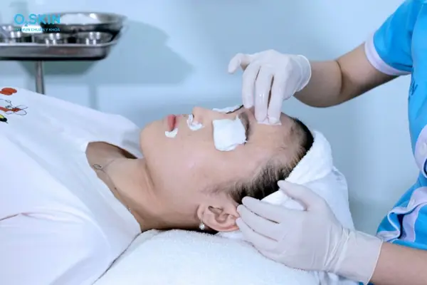 Sau Khi Peel Da Có Được Đắp Mặt Nạ Không