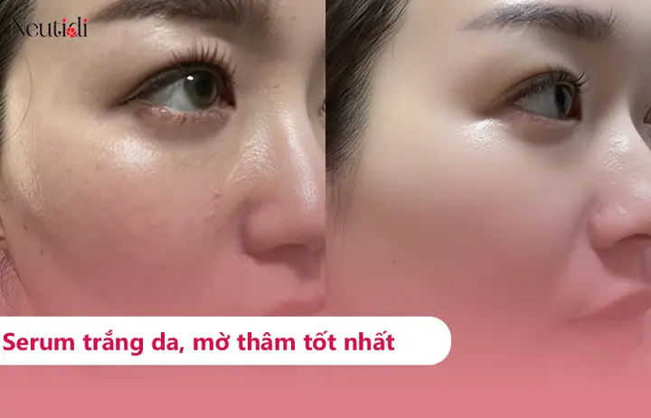Serum Dưỡng Trắng Da Hiệu Quả