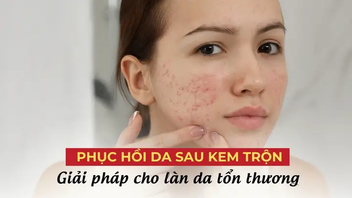 Serum Phục Hồi Da Sau Kem Trộn Serum Phục Hồi Da Sau Kem Trộn