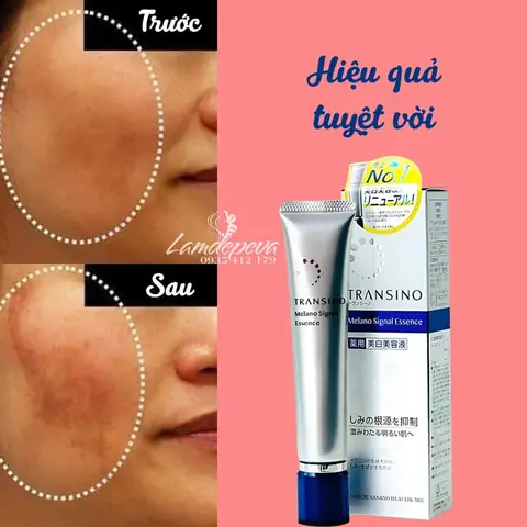 Serum Trị Nám Tốt Của Nhật Serum Trị Nám Tốt Của Nhật