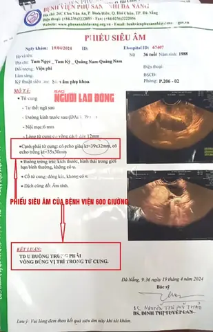 Siêu Âm Canh Trứng Ở Đà Nẵng