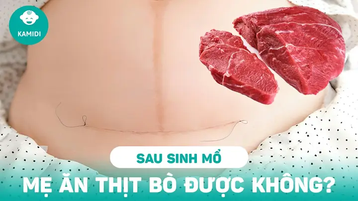 Sinh Mổ Có Ăn Măng Được Không