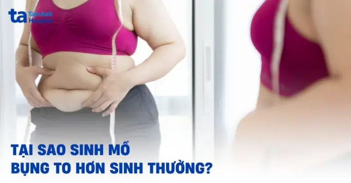 Sinh Mổ Làm Sao Để Bụng Nhỏ Lại