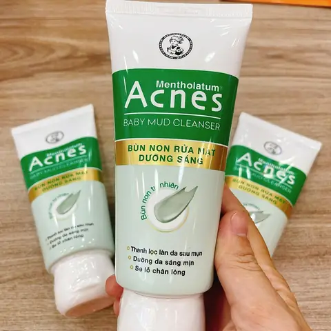 Sữa Rửa Mặt Bùn Non Acnes Review