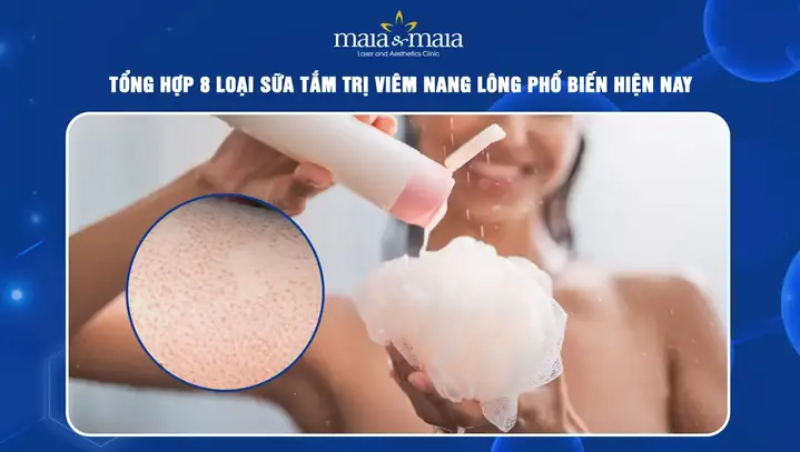 Sữa Tắm Đặc Trị Viêm Nang Lông