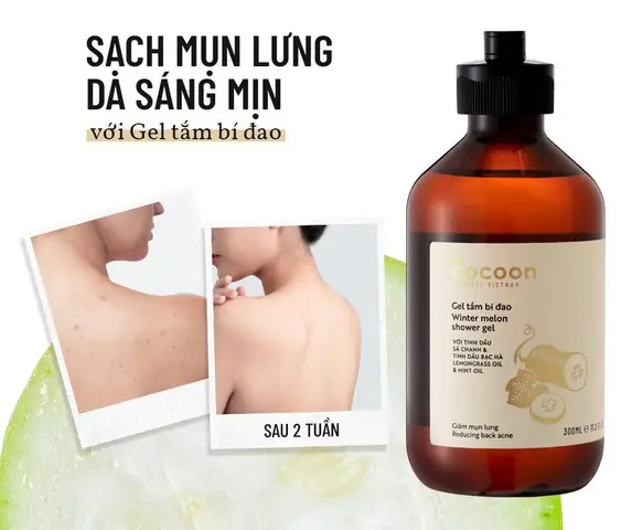 Sữa Tắm Trị Mụn Lưng Tốt