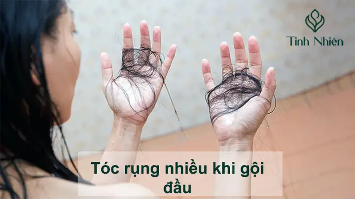 Tại Sao Tóc Rụng Nhiều Khi Gội Đầu