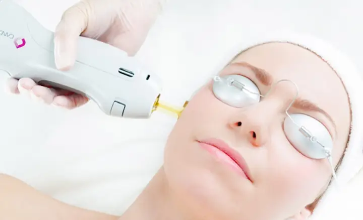 Tẩy Lông Mặt Có Tốt Không