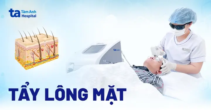 Tẩy Lông Mặt Có Tốt Không