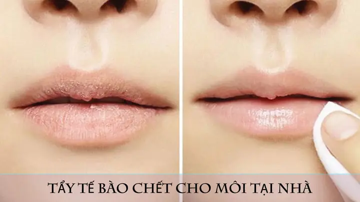 Tẩy Tế Bào Chết Cho Môi Tại Nhà Tẩy Tế Bào Chết Cho Môi Tại Nhà
