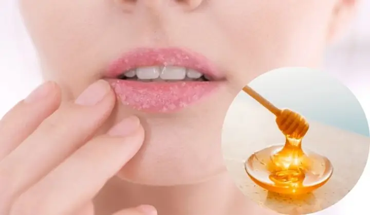 Tẩy Tế Bào Chết Môi Bằng Chanh