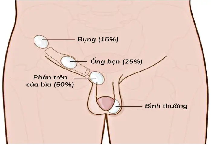 Thai Bao Nhiêu Tuần Thì Tụt Bụng