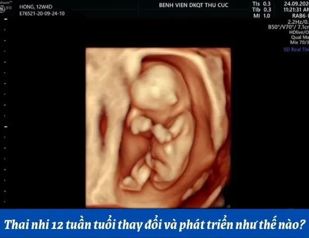Thai Nhi 3 Tuần Tuổi Mẹ Nên Ăn Gì