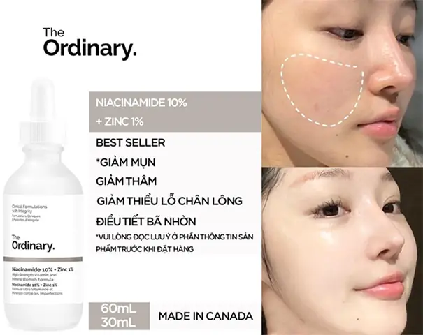 The Ordinary Niacinamide 10 Zinc 1 Giá