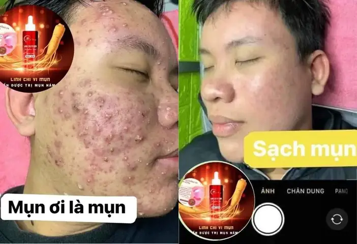 Thuốc Tái Tạo Da Tốt Nhất