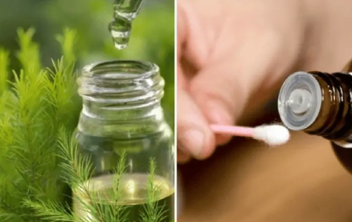 Tinh Chất Tràm Trà Trị Mụn