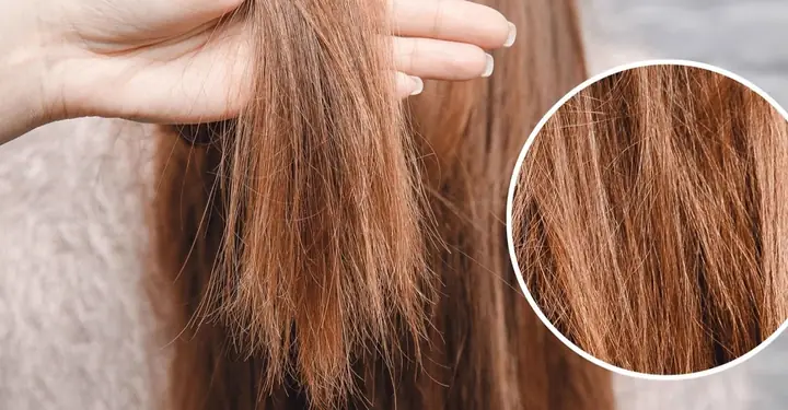 Tóc Bị Chẻ Ngọn Phải Làm Sao